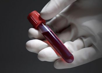 SFH successfully ends pilot activity for strengthening HIV testing in Nigeria