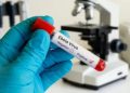 New Ebola virus discovered in Nigeria is genetically related to Kenya’s viral strain 