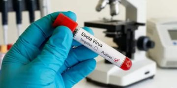 New Ebola virus discovered in Nigeria is genetically related to Kenya’s viral strain 