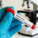 New Ebola virus discovered in Nigeria is genetically related to Kenya’s viral strain 