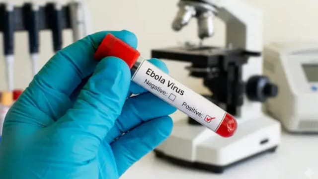 New Ebola virus discovered in Nigeria is genetically related to Kenya’s viral strain